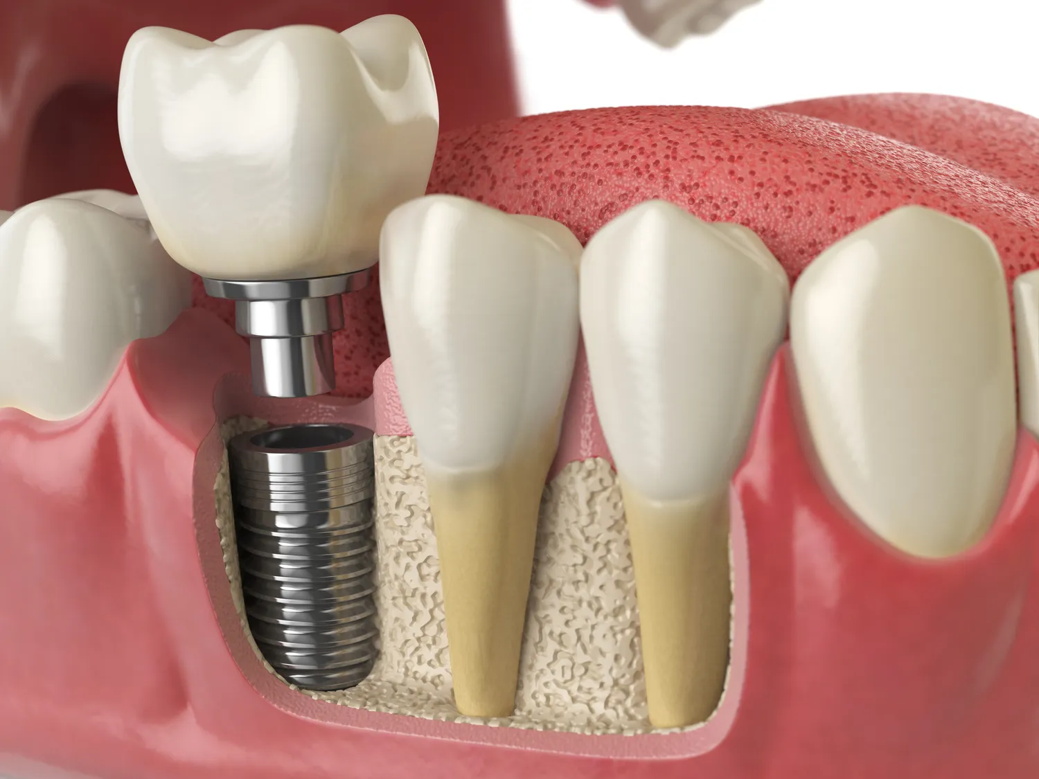 Endodoncja Szczecin