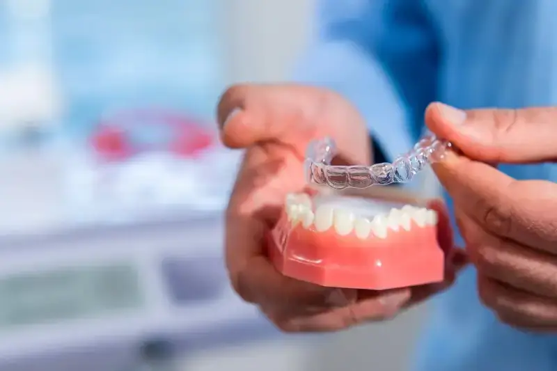 Aparat nakładkowy Invisalign